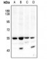 Anti-AKT1/2 (pT308/309) Antibody